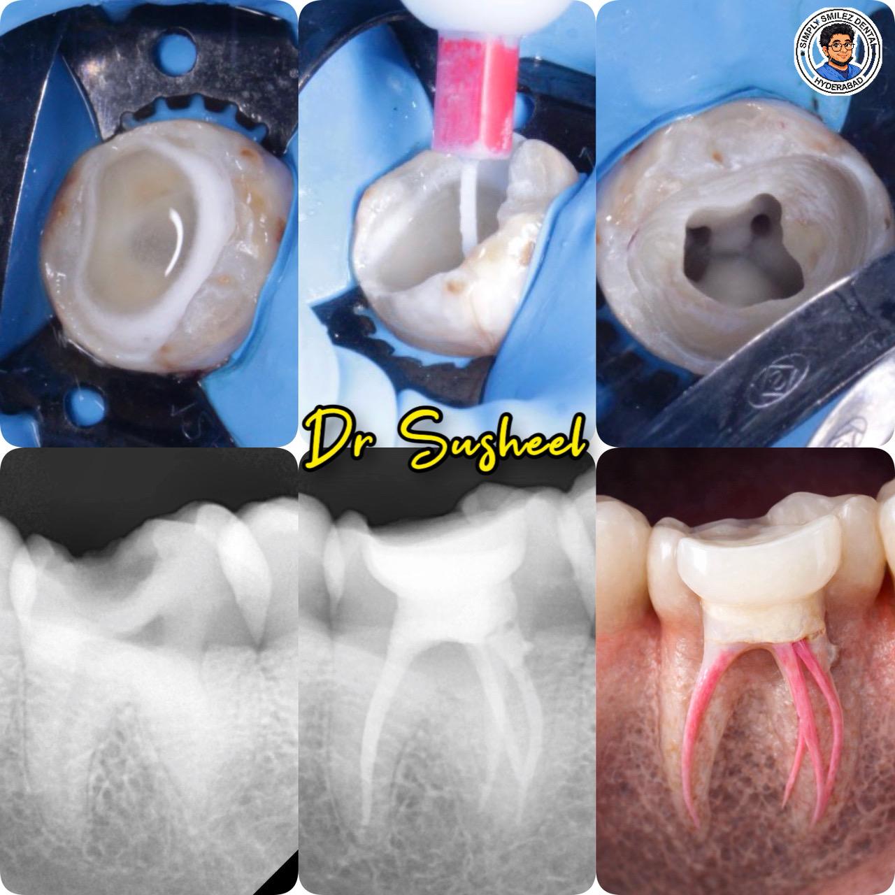 Simply Smilez Dental Clinic Gallery 10