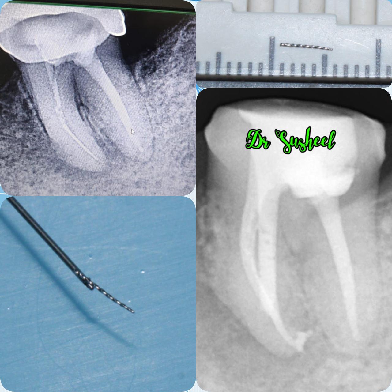 Simply Smilez Dental Clinic Gallery 15
