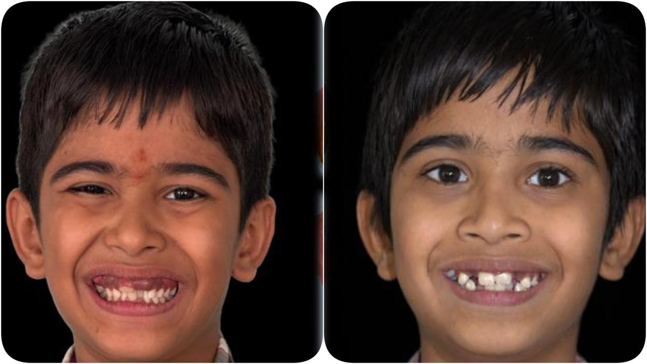 Simply Smilez Dental Clinic Gallery 3