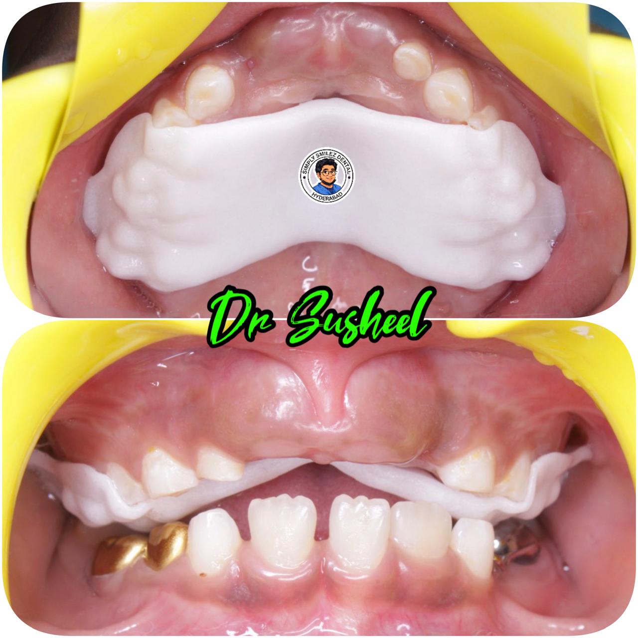 Simply Smilez Dental Clinic Gallery 5