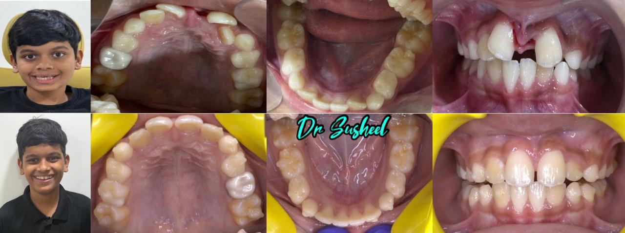 Simply Smilez Dental Clinic Gallery 6