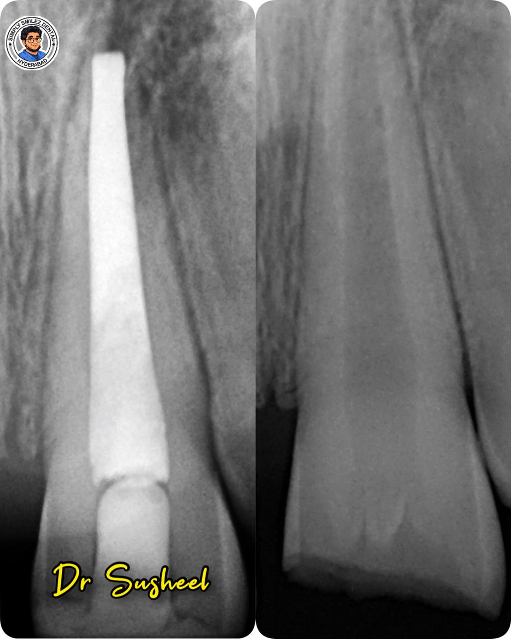 Simply Smilez Dental Clinic Gallery 8